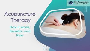 Acupuncture Therapy: How It Works, Benefits, and Risks