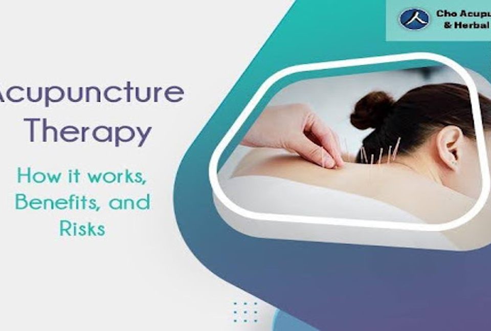 Cho Acupuncture | Acupuncture Therapy: How It Works, Benefits, and Risks