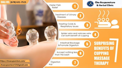 Cho Acupuncture | Cupping Therapy: Benefits, How It Works, and What to Expect