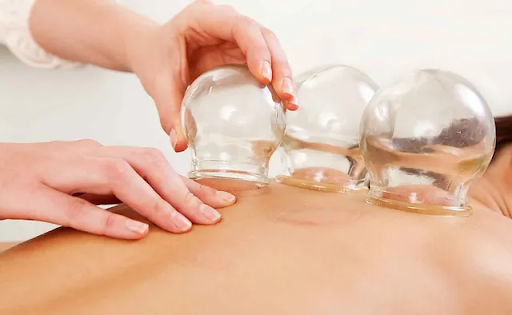 Cho Acupuncture | Exploring Traditional Chinese Medicine: Acupuncture, Cupping, and Gua Sha