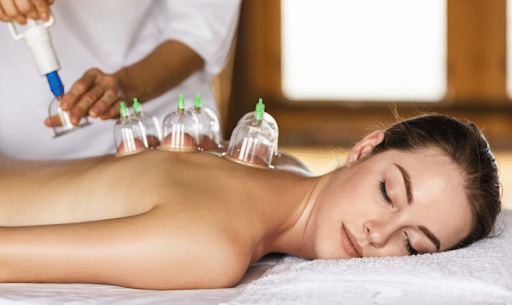 Cho Acupuncture | Cupping Therapy: Benefits, How It Works, and What to Expect